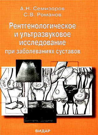 Рентгенологическое и ультразвуковое исследование при заболеваниях суставов 